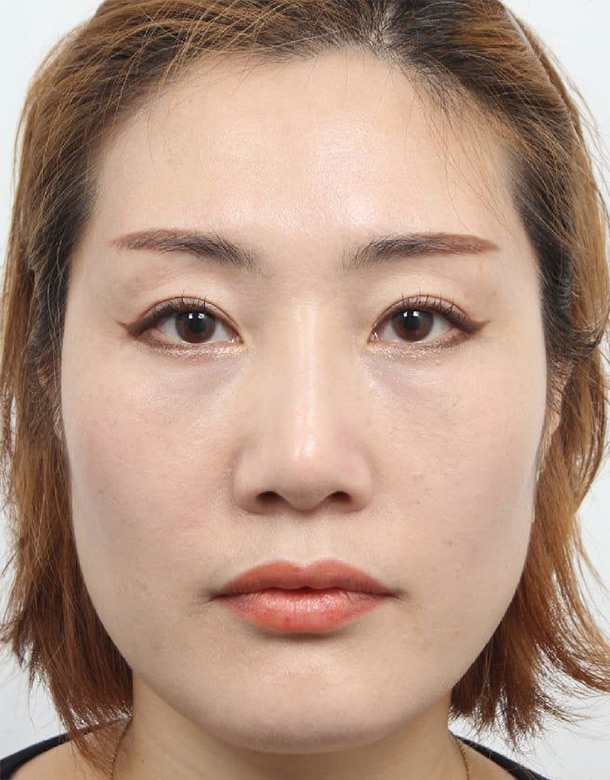 CASE 01 Before