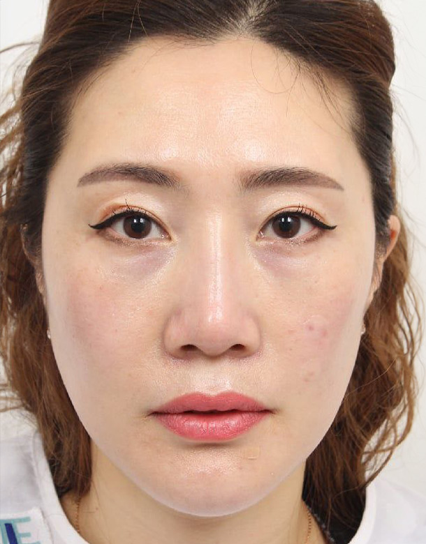 CASE 01 After