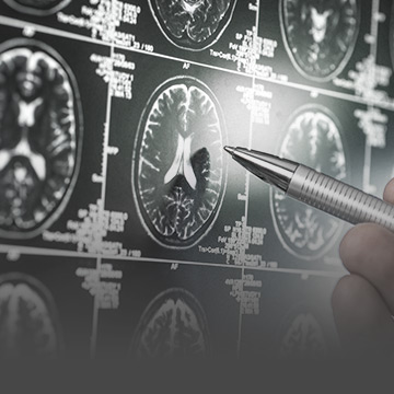 ผลตรวจ MRI ปกติ