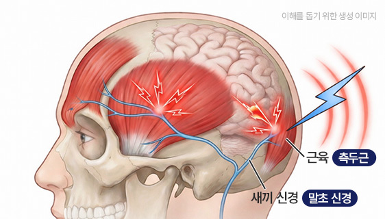ภาพอธิบายความสัมพันธ์ระหว่างเส้นประสาทส่วนปลายและกล้ามเนื้อ