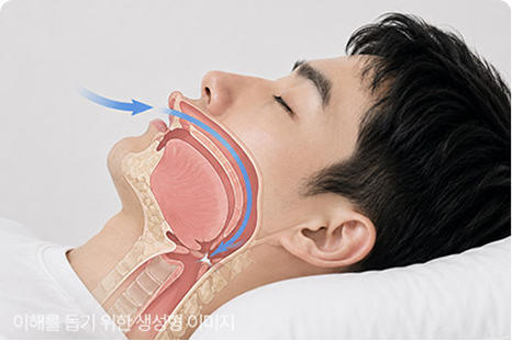 ความรู้สึกสะดุ้งตื่นเพราะหายใจไม่ออก